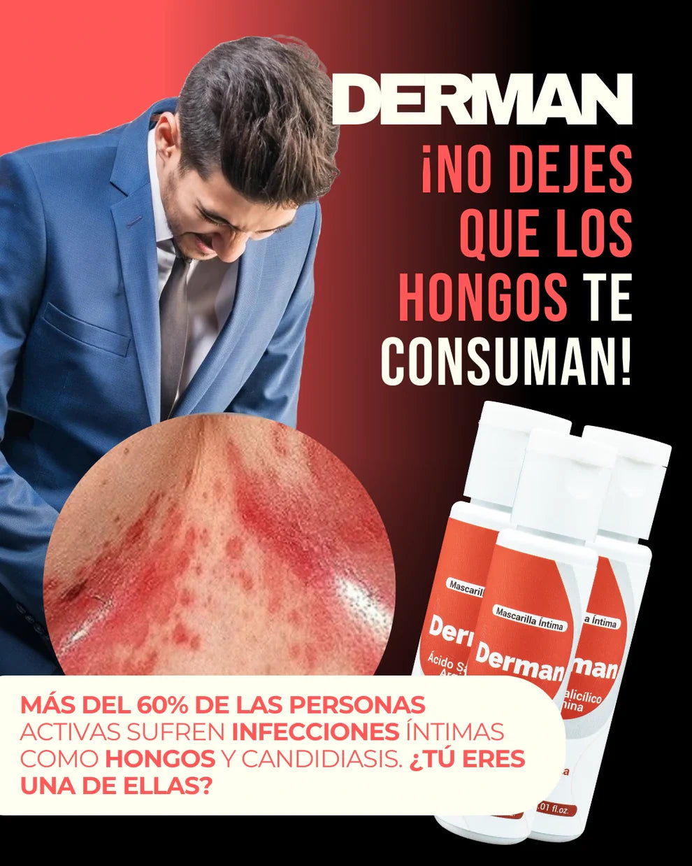 Derman: Previene y Alivia Irritaciones Intimas